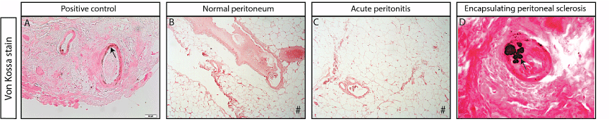 Photomicrographs