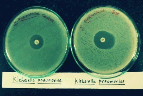 biologically
