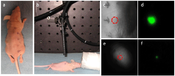 Endoscopic