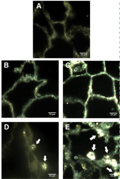 microscopy