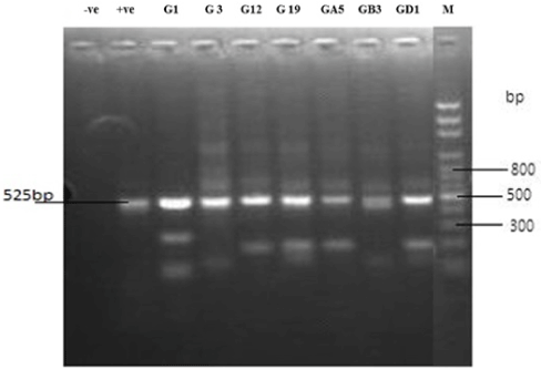 electrophoresis