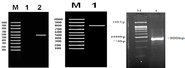 Electrophoretic