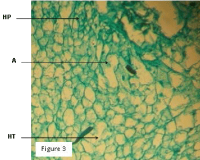 Hyperplastied