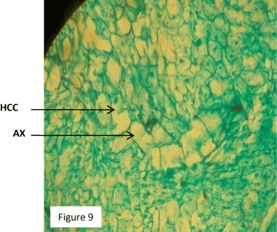 cortical