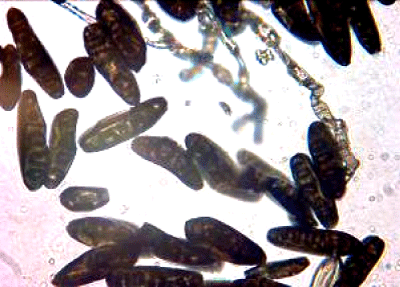 Conidia
