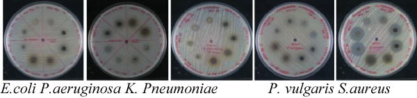 Antibacterial