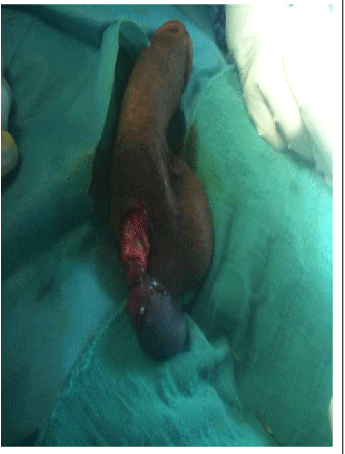 Surgical