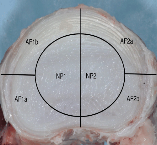 intervertebral