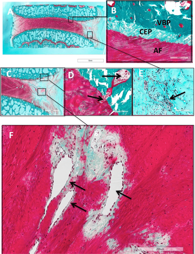 histological