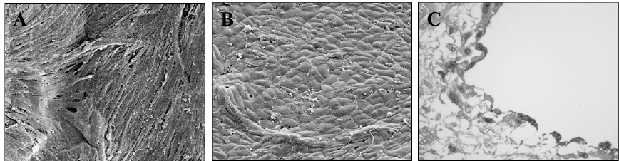 Endothelialisation