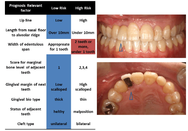 dental