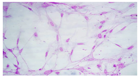 infection