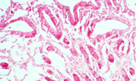 intestine