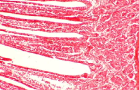 intestine