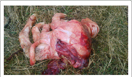 schistosomus