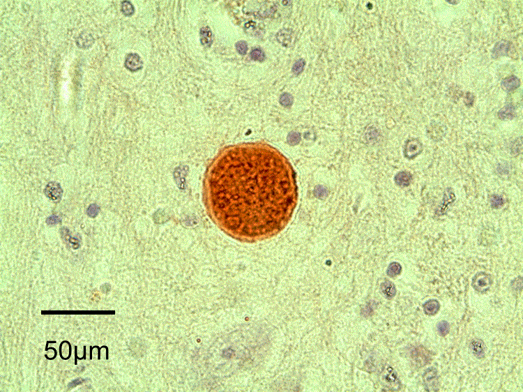 protozoal