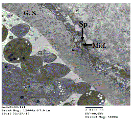 micrograph