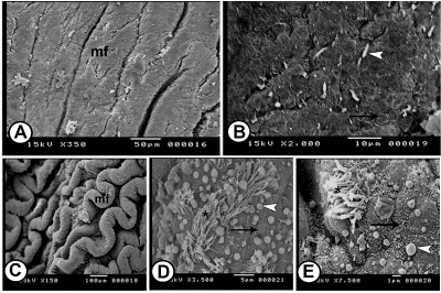 Histological
