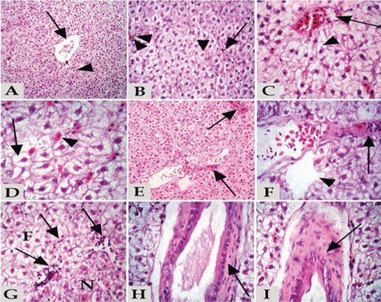 parenchyma