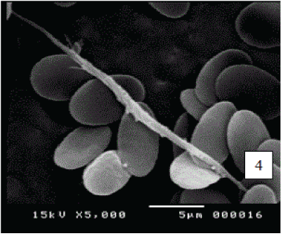 micrograph