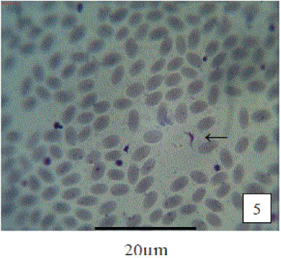 Trypanosoma