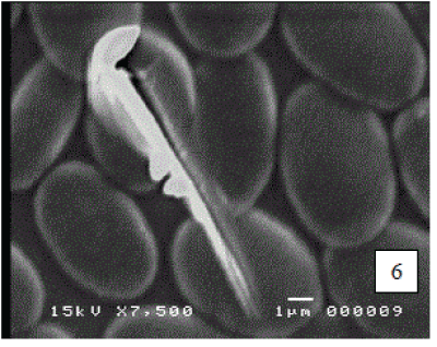 micrograph