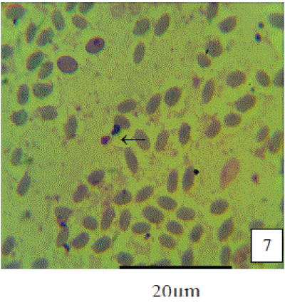 Babesia