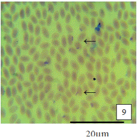 Photomicrograph