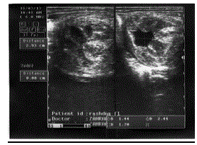 Ultrasonographic
