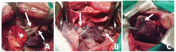occlusion
