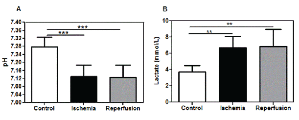 ischemia