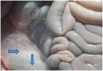 omentum