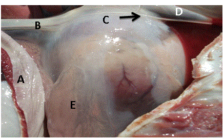 pericardial