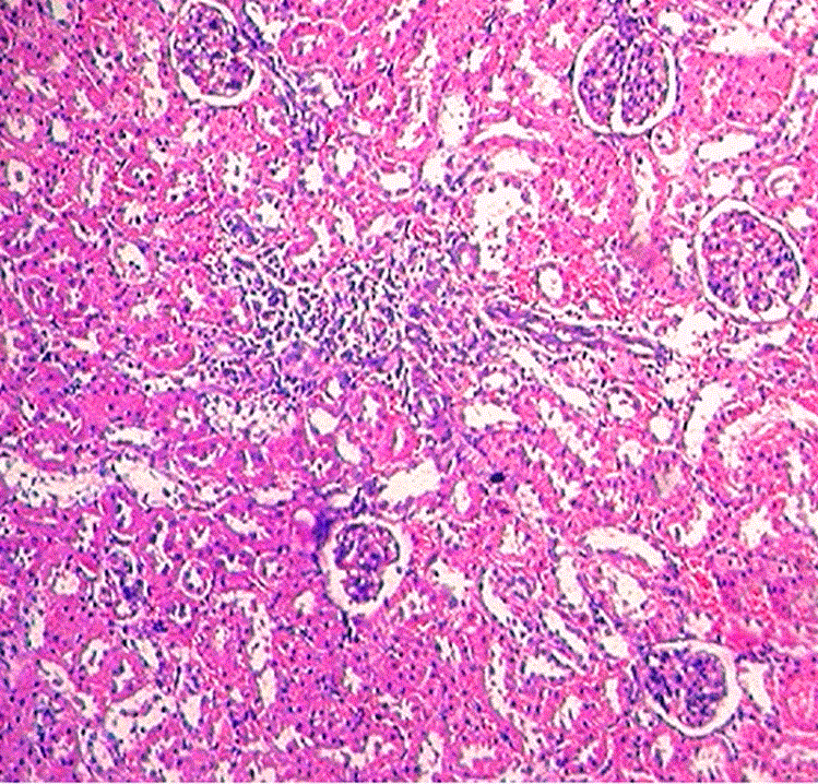 intertubular