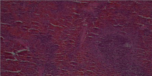 spleen