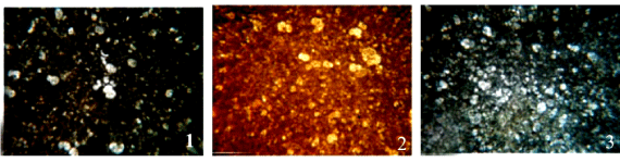 Photomicrograph