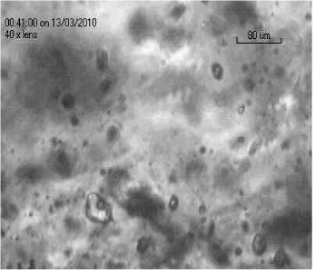 Photomicrograph