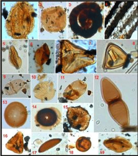 Magnification
