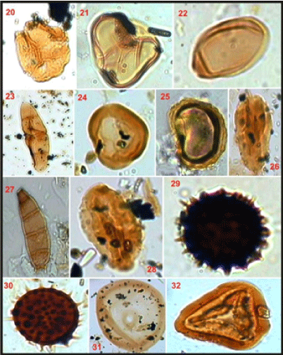 Magnification