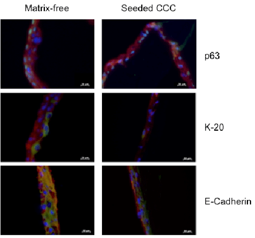 urothelial