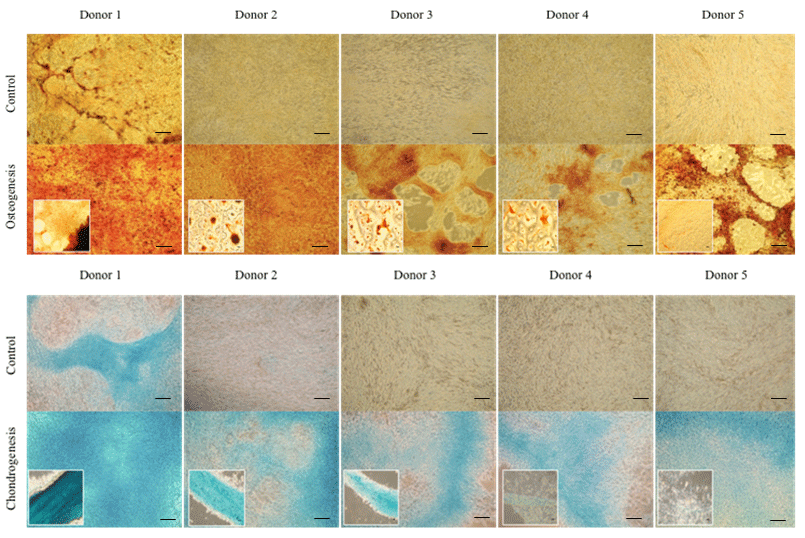 Osteogenesis