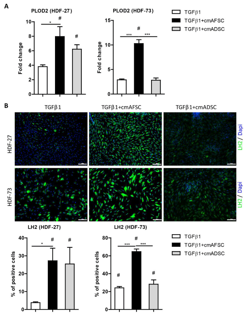 Fibroblasts