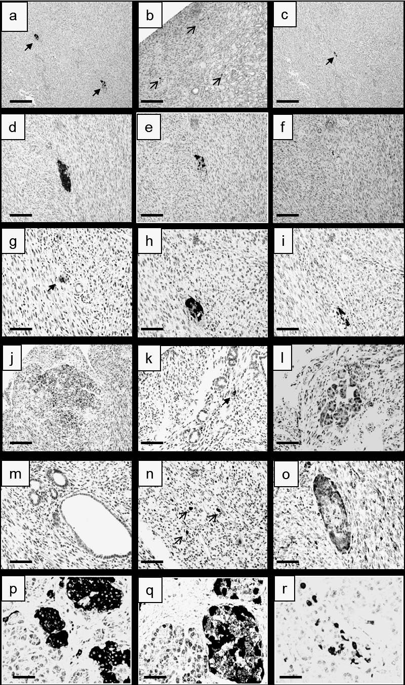 Immunohistochemical