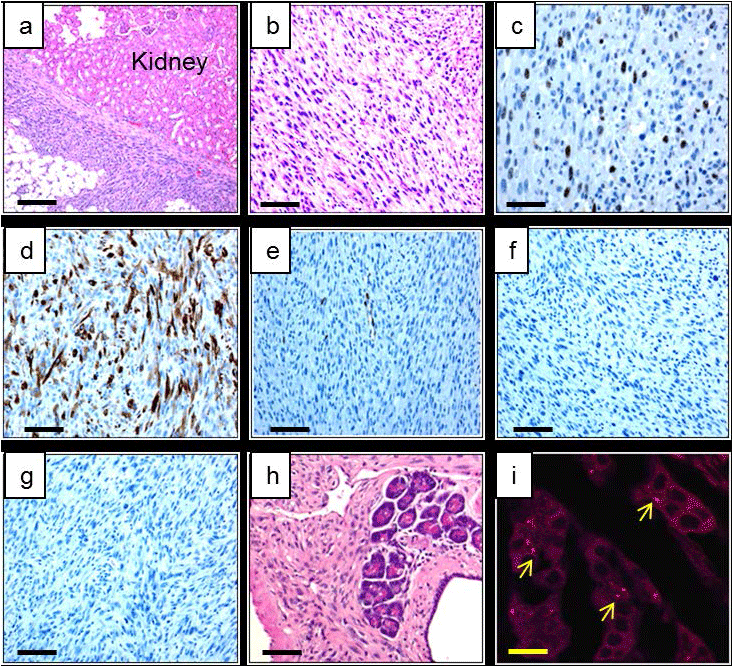 Immunohistochemical