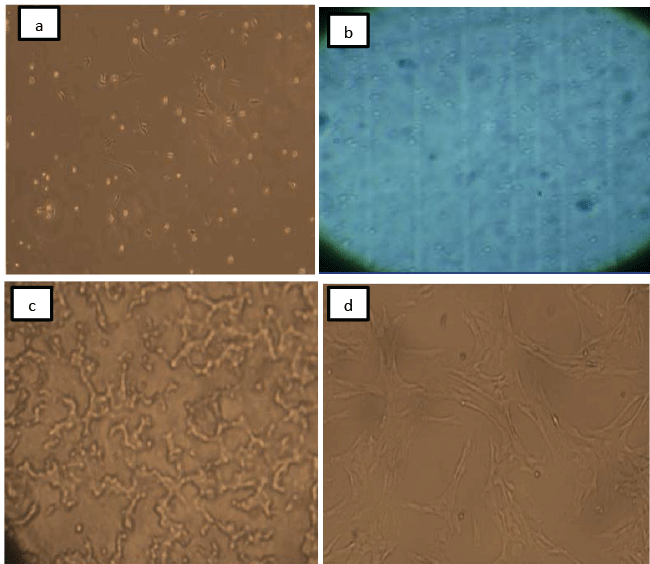 Mesenchymal