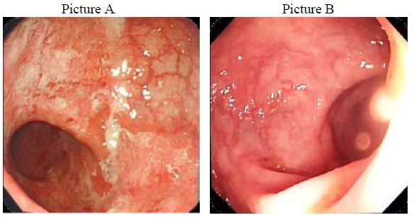 diarrheal