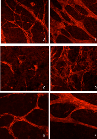 Confocal