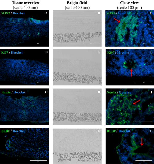 Immunohistochemistry