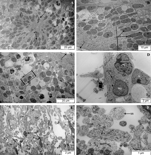micrographs