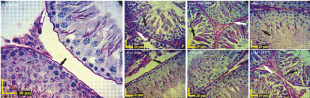 Histological